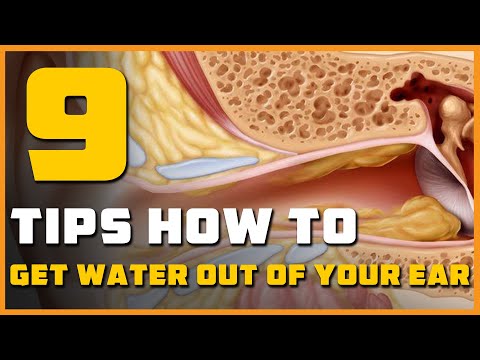 9 How to Get Water Out of Your Ear