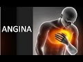 Angina