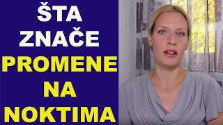 ŠTA ZNAČE promene na NOKTIMA - vertikalne brazde i bele tačke / dr Bojana Mandić ŠTA ZNAČE promene na NOKTIMA - vertikalne brazde i bele tačke / dr Bojana Mandić