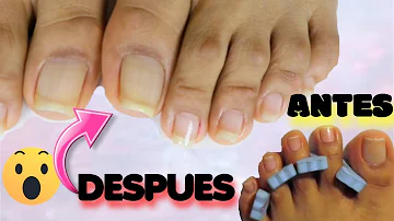 ¿Cómo puedo hacer que las uñas de mis pies crezcan más rápido?