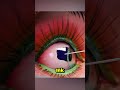NEVER Get an Eye Tattoo😱👁️