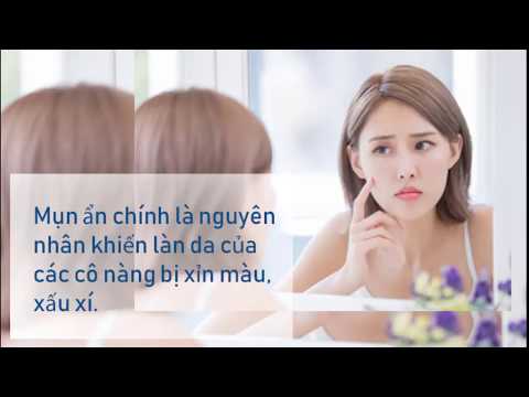 Cách trị mụn ẩn tại nhà hiệu quả và an toàn nhất