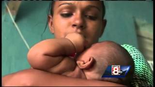 Zika Virus Causing New Concerns For Maines Expecting Mothers