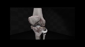 Revolutionizing Medical Imaging: 3D VR/AR Visualization of CT & MRI | Specto Medical at DKOU 2024