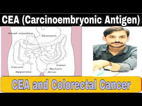 CEA Test || Carcinoembryonic Antigen