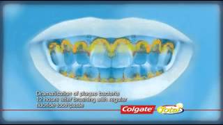 Henry Schein Uk - Colgate Total Toothpaste
