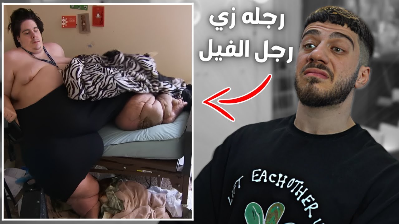 حتى الدكتور جلده على وزنه