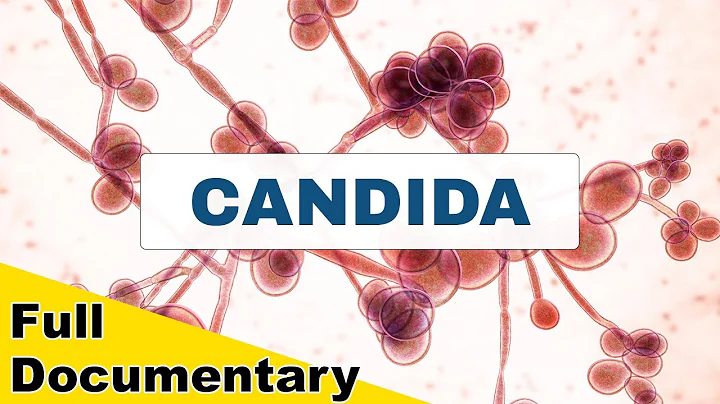 Candida: The Invisible Disease of 21st Century (A ...