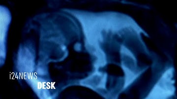 Israeli Scientists Have Created the First Artificial Womb