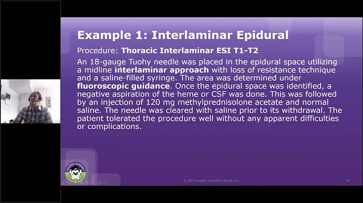 HCGTV: Webinar Snippet - Coding for Pain Management - Interlaminar Epidural