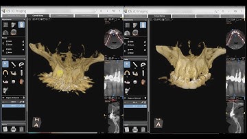 Cs 9600 MAR Comparison (Lots Of Metal)