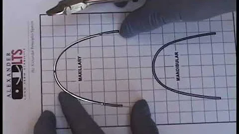 How to place Omega Loops into Upper Rectangular Stainless Steel Archwire