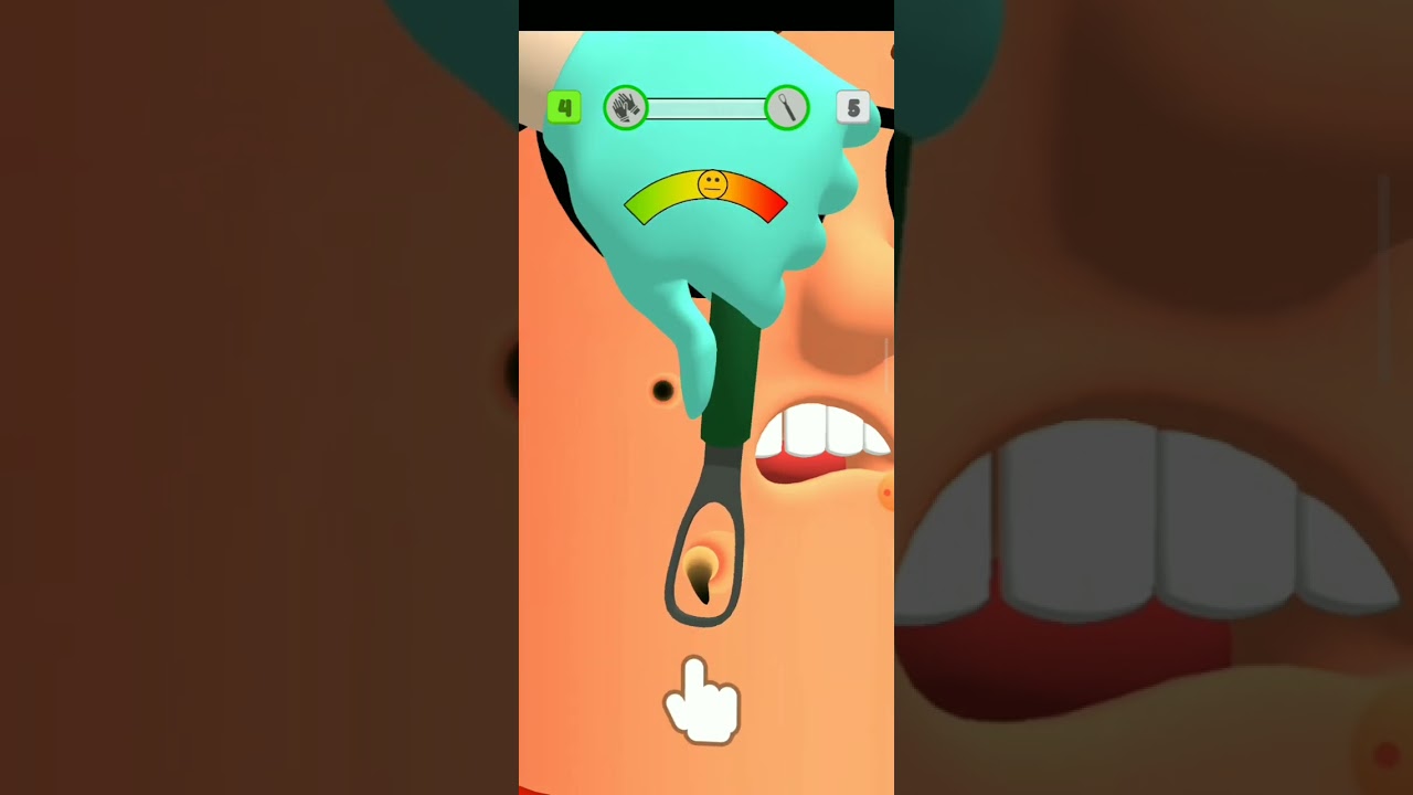 pimple remove ASMR game