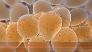 How Cryolipolysis Fat Lipo Freeze Works