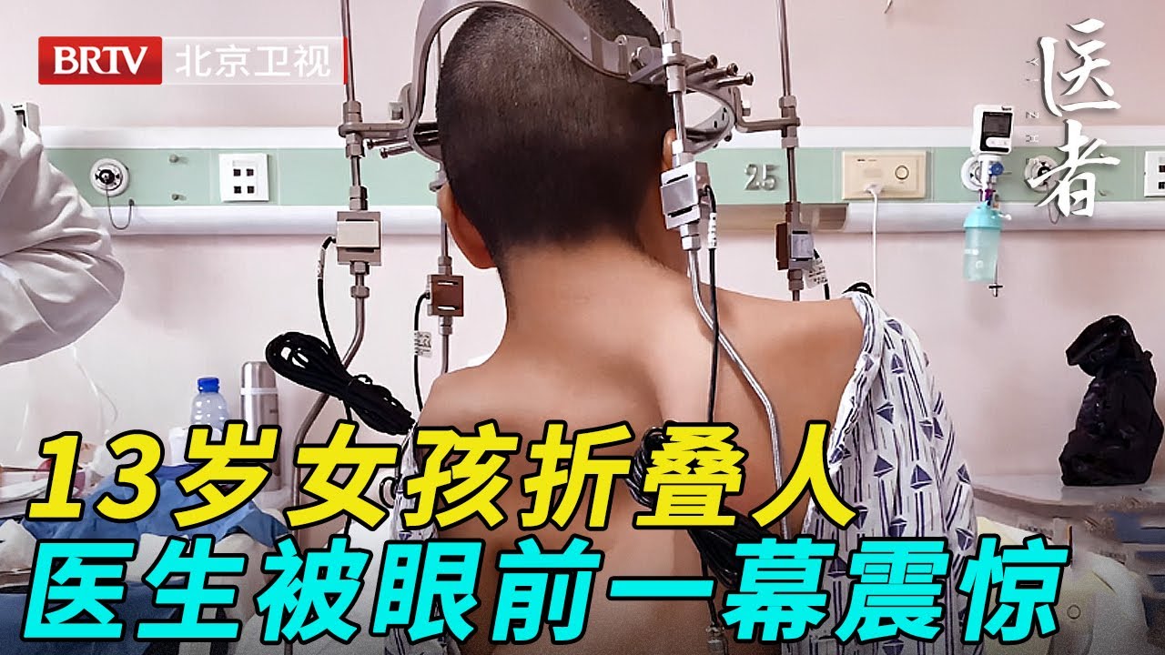 13岁大山女孩身体折叠100度，医生掀开衣服，被眼前一幕震惊【医者】