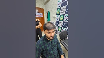 Scalp Micropigmentation