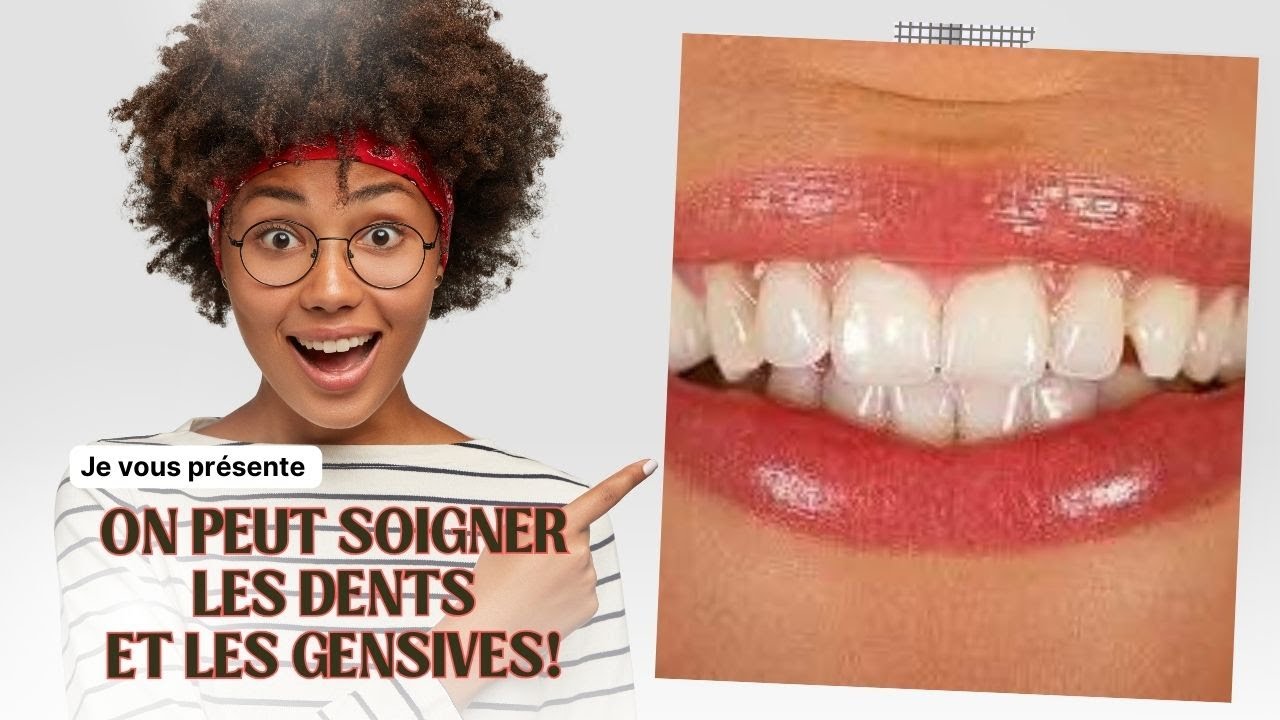 On peut soigner les DENTS et les GENCIVES! - YouTube