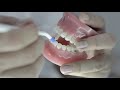 Como es el uso del KIT de higiene oral en el tratamiento  de ortodoncia