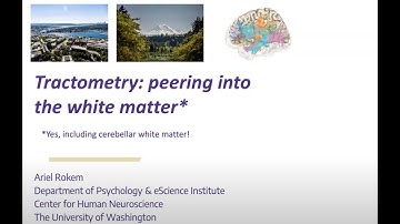 Ariel Rokem (University of Washington)