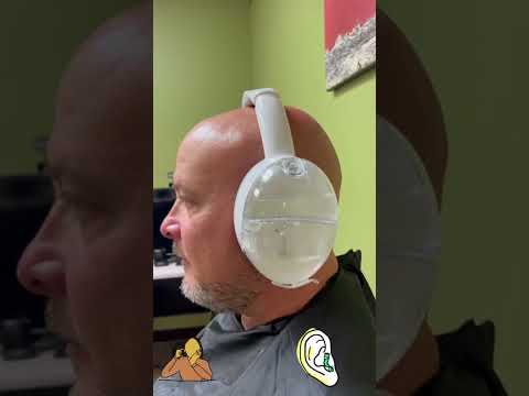 #earwax#safkan #otoset #cerumen#waxremoval