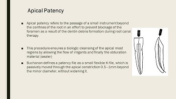 RECAPITULATION VIDEO