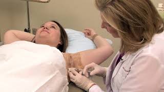 Botox for Underarm Sweating (Hyperhidrosis)  by Dr. Lori Stetler