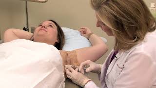 Botox For Underarm Sweating Hyperhidrosis - By Dr. Lori Stetler