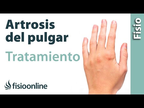 Vídeo: Contracciones Del Pulgar: Causas, Tratamiento Y Prevención