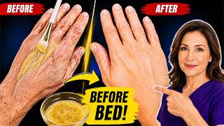 Rub This on Your Hands Before Bed… They’ll Look Years Younger | Remedy's Nutrition
