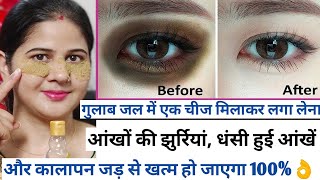 फ्रिज से 1 चीज निकाल कर लगा लेना,आंखों का कालापन, झुरिया,puffy eyes जड़ से खत्म, Kale ghere ka ilaaj