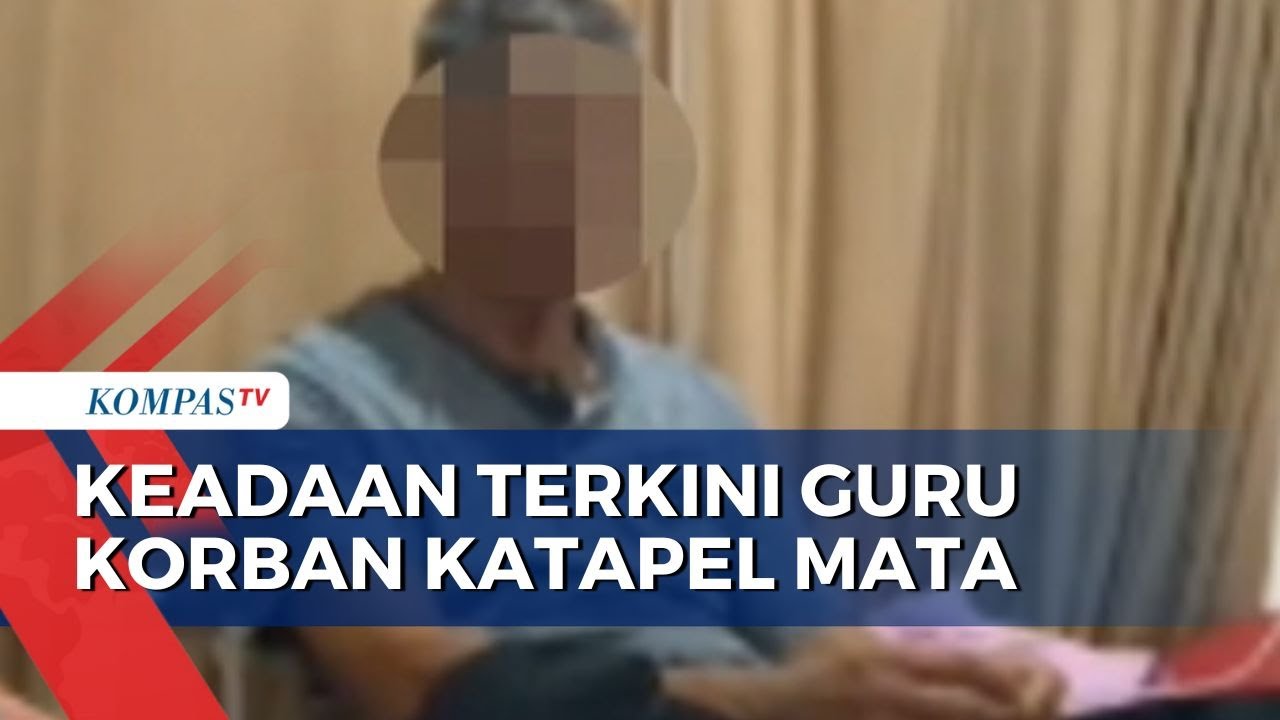 Bagaimana Keadaan Guru SMAN 7 Rejang Lebong Bengkulu, Korban Aniaya Katapel di Mata?