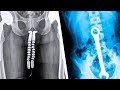 20 Strangest Things Found In An X-Ray