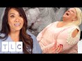 Woman Gets Her 35 Year Old Pilar Cyst Removed: It's Time For 'Big Bertha' To Go! | Dr. Pimple Popper