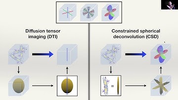 RWI - Dr Reymbaut on conventional techniques in diffusion MRI white-matter tracking - Part 3/5