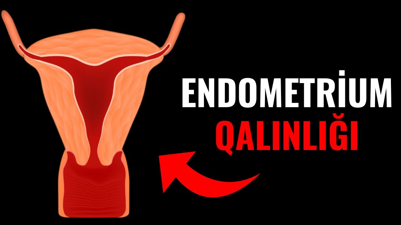 Endometrium Qalınlığı az olduqda Müalicə İlə normal Qalınlığa çatdırmaq olar?