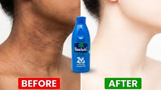 Coconut oil removes black neck and dark spots on legs | How to use coconut oil for skin whitening