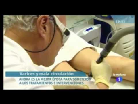 Varices medico el mejor de