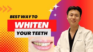Best Teeth Whitening Method? | DENTIST ANSWERS