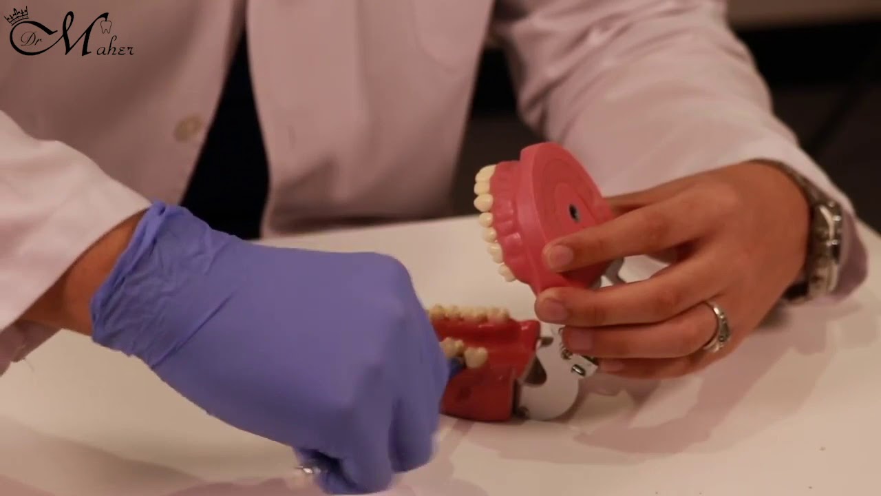 Clinical Dental Advice for Extraction.شرح لعملية خلع الاسنان