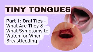 Tiny Tongues Navigating Newborn Tongue Ties - Part 1 Stages Breastfeeding Symptoms