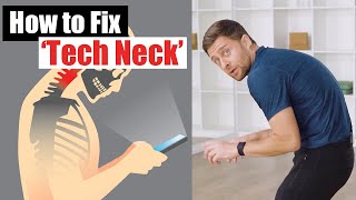 Fix Forward Head Posture  3 Exercises to Reverse ‘Tech Neck’