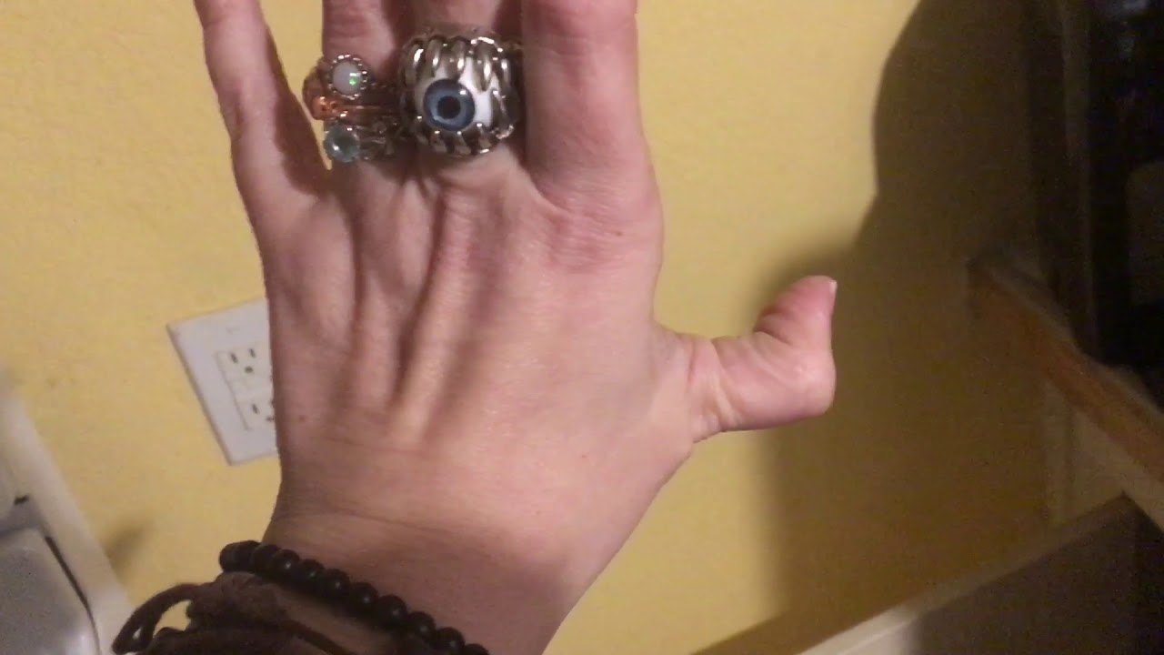 Doublejointed thumb YouTube