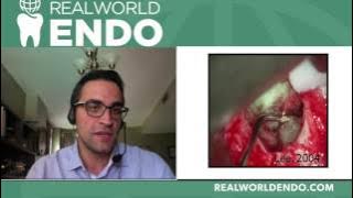 Download lagu Root End Filling Materials: An Endodontic Revolution Dr Chafic Safi Interview