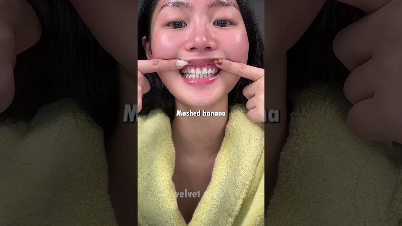 Her Teeth Look Professionally Whitened But It S DIY 