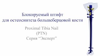 Хирургическая техника PTN Блокируемый штифт для остеосинтеза большеберцовой кости