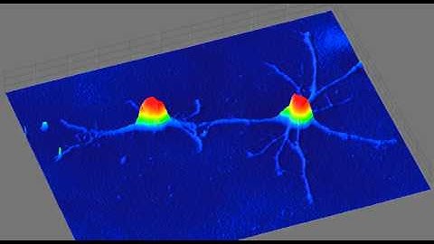 Dynamic Phase Shifting Microscopy Video: Oligodendrocytes