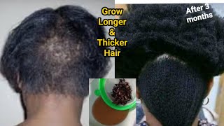 Grow hair thicker & longer with Onion & Coconut oil !! Super fast hair growth challenge