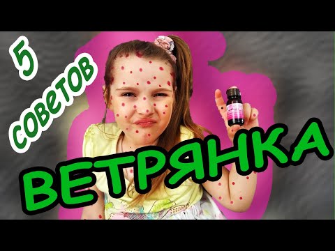 5 советов при ветрянке. Челлендж - две недели в розовом.