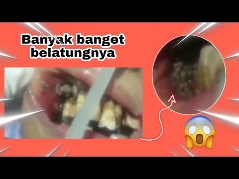 MULUT DIPENUHI BELATUNG || ngeri banget