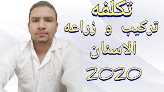 اسعار التركيبات الثابته و زراعه الاسنان 2020